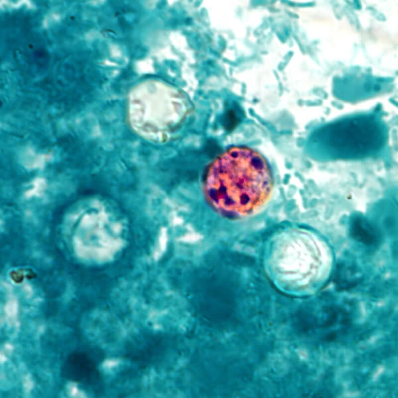 Cyclospora Cdc